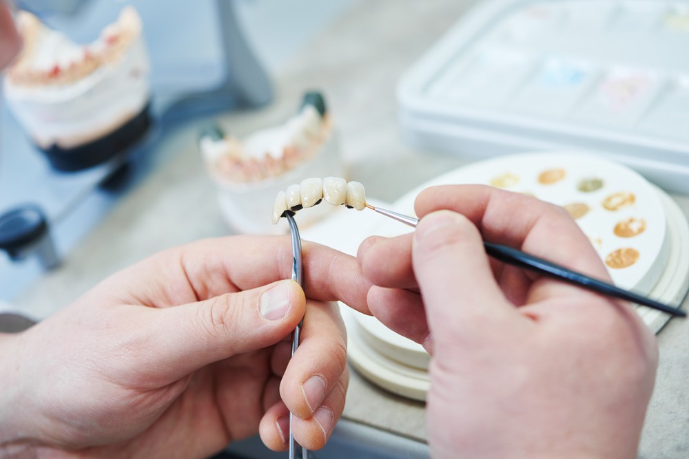 Fabrication de prothèses dentaires à Dijon